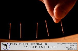 preston-cary-nc-acupuncture