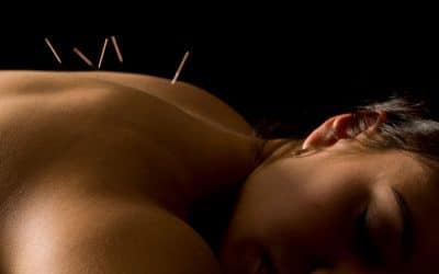 What Can Acupuncture Treatments Do for You?